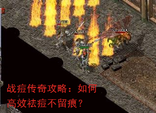 战痘传奇攻略:如何高效祛痘不留痕? 战痘传奇攻略:如何高效祛痘不留痕?
